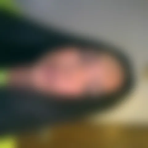 T****e