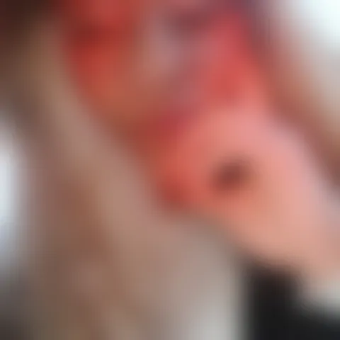 P********a