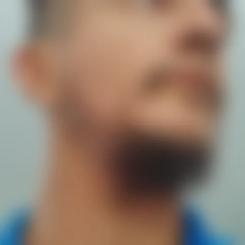 S******r