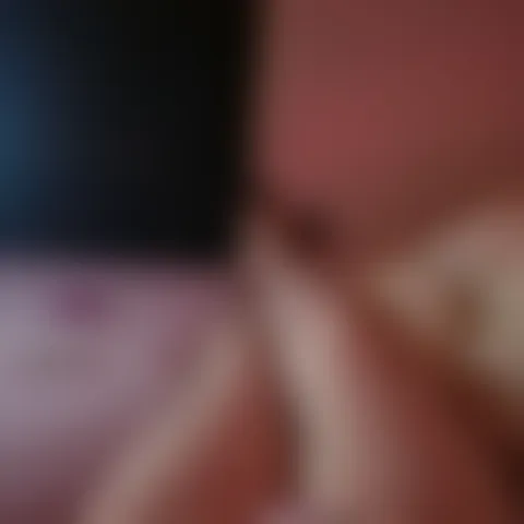 M*****a